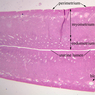 B97, Uterus, 1x Labeled (H&E)