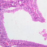 B100, Uterus (Secretory Phase), 40x (H&E)