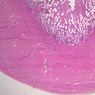 B100, Uterus (Secretory Phase), 1x (H&E)