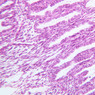 B99, Uterus (Secretory Phase), 20x (H&E)
