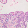 B98, Uterine Cervix, 20x (H&E)