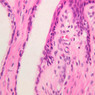 B98, Uterine Cervix, 40x (H&E)