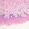 B98, Vagina, 10x (H&E)