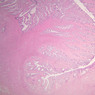 B98, Vagina, 1x (H&E)