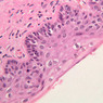 B98, Vagina, 40x (H&E)