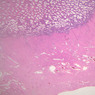 B98, Vagina, 1x (H&E)