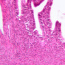 Female