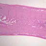 Female