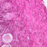 B96, Ovary, 40x (H&E)