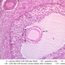 B94, Ovary, 20x Labeled (H&E)