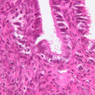 B96, Uterine Tube, 40x (H&E)