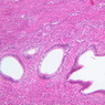 B97, Uterine Tube, 10x (H&E)