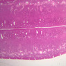 B97, Uterine Tube, 1x (H&E)