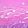 B15, Jejunum, 20x (H&E)
