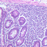 B12, Jejunum, 20x (H&E)