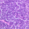 B18, Ileum, 40x (H&E)