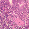 B18, Ileum, 40x (H&E)