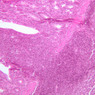 B18, Ileum, 10x (H&E)