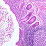 B20, Appendix, 10x (H&E)