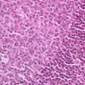 B20, Appendix, 40x (H&E)