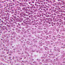 B20, Appendix, 40x (H&E)