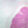 A32, Lymph Node, 2.5x (H&E)