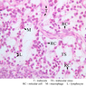 A32, Lymph Node, 40x Labeled (H&E)