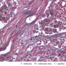 A34, Lymph Node, 40x Labeled (Reticulin)