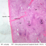 A37, Spleen, 2.5x Labeled (H&E)