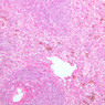 A40, Spleen, 10x (H&E)