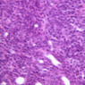 A44, Thymus (Infant), 40x (H&E)