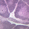 A45, Thymus (Infant), 2.5x (H&E)