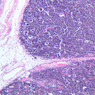 A45, Thymus (Infant), 10x (H&E)