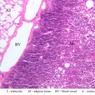 A46, Thymus (Adolescent), 20x Labeled (H&E)