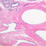 B82, Testis, 10x (H&E)