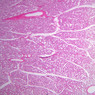 B82, Testis, 1x (H&E)