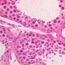 B82, Testis, 40x (H&E)