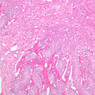 B86, Testis (Prepubertal), 10x (H&E)