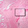 B79, Testis (Rete Testis), 2.5x Labeled (H&E)