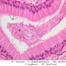 B80, Epididymis, 40x Labeled (H&E)
