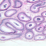 B81, Epididymis, 10x (PAS)