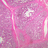 B89, Seminal Vesicle, 2.5x (H&E)