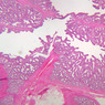B89, Seminal Vesicle, 2.5x (H&E)