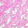 B90, Prostate, 10x (H&E)