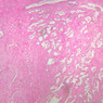 B90, Prostate, 2.5x (H&E)