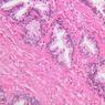 B91, Prostate, 20x (H&E)