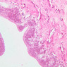 B91, Prostate (Urethra), 20x (H&E)