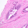 B91, Prostate, 10x (H&E)