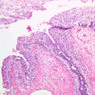 B92, Prostate (Prepubertal), 10x (H&E)