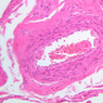 B85, Penis, 20x (H&E)